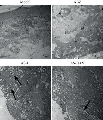 Details are in the caption following the image