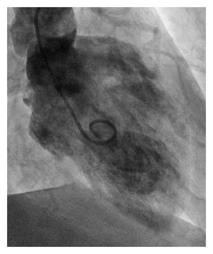 Details are in the caption following the image