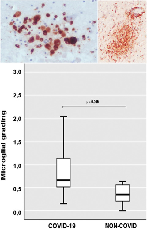 COVID-19-related neuropathology and microglial activation in elderly with and without dementia