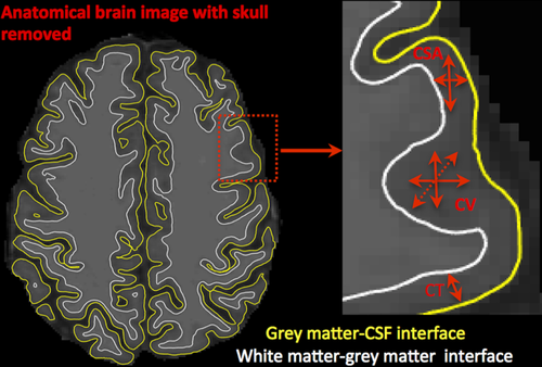 Details are in the caption following the image Details are in the caption following the image