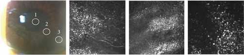 Details are in the caption following the image