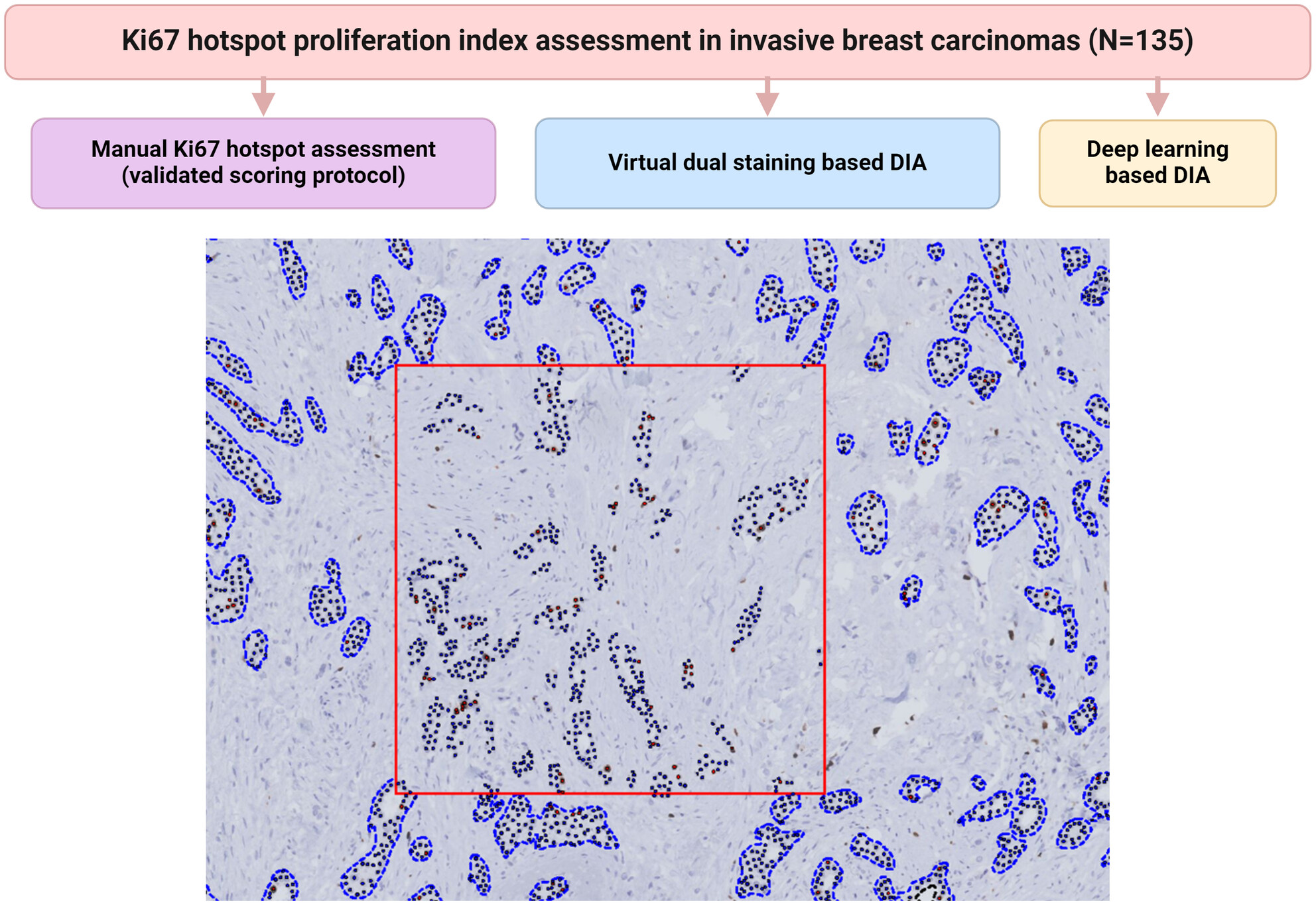 Advancing Ki67 hotspot detection in breast cancer: a comparative analysis of automated digital image analysis algorithms