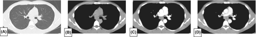 Details are in the caption following the image