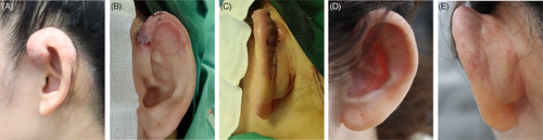 Details are in the caption following the image Details are in the caption following the image