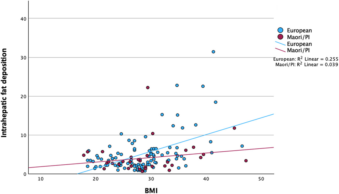 An anatomical analysis of liver volume and quality by ethnicity in a New Zealand population