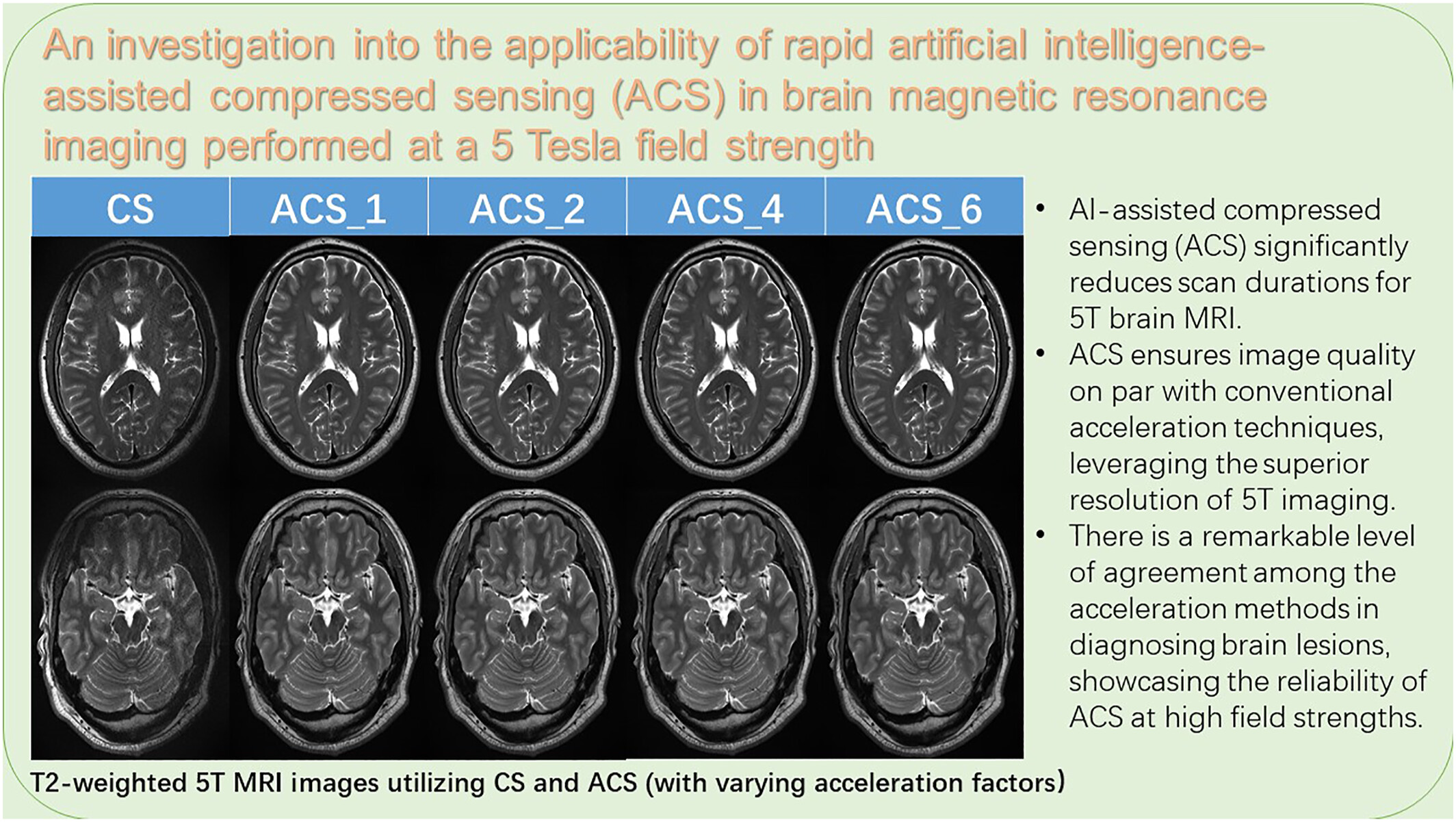 An investigation into the applicability of rapid artificial intelligence-assisted compressed sensing in brain magnetic resonance imaging performed at 5 Tesla field strength