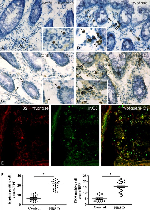 Expression of inducible nitric oxide synthase in mast cells contributes to the regulation of inflammatory cytokines in irritable bowel syndrome with diarrhea
