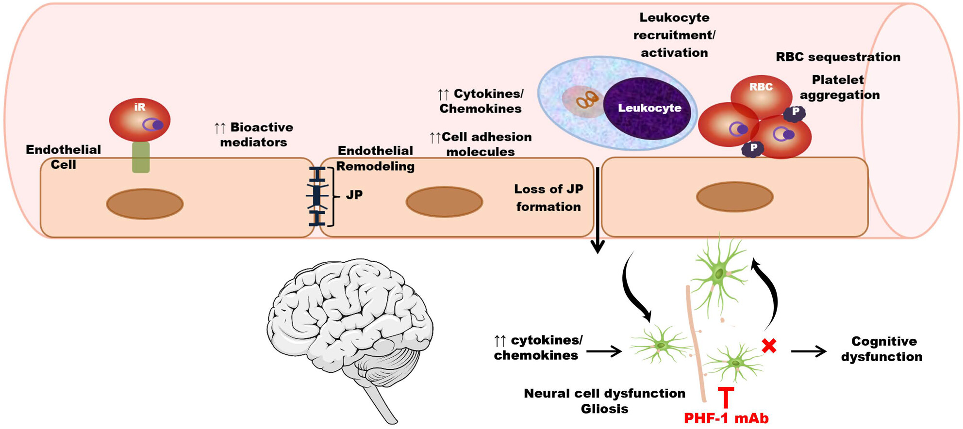 Effects of anti-tau immunotherapy on reactive microgliosis, cerebral endotheliopathy, and cognitive function in an experimental model of cerebral malaria