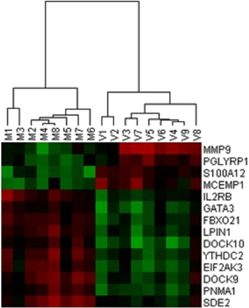 Behçet syndrome: The disturbed balance between anti- (CLEC12A, CLC) and proinflammatory (IFI27) gene expressions