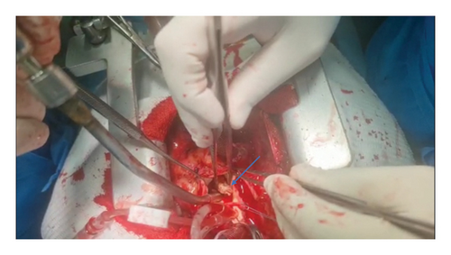 Details are in the caption following the image Details are in the caption following the image