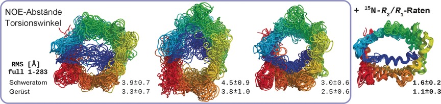 Hochauflösende NMR-spektroskopische Bestimmung der dynamischen Struktur von Membranproteinen