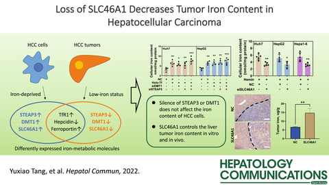 Loss of SLC46A1 decreases tumor iron content in hepatocellular carcinoma