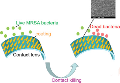 Novel Antimicrobial Coating on Silicone Contact Lens Using Glycidyl Methacrylate and Polyethyleneimine Based Polymers