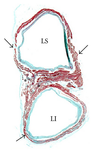 Details are in the caption following the image