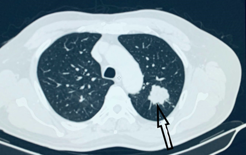 Details are in the caption following the image