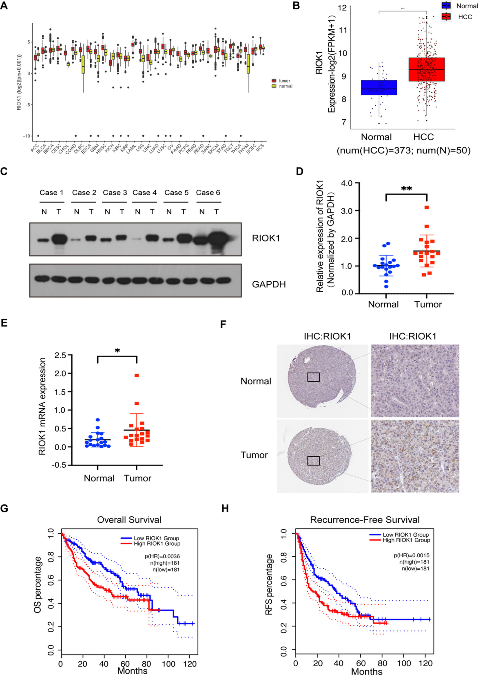 RIOK1: A Novel Oncogenic Driver in Hepatocellular Carcinoma