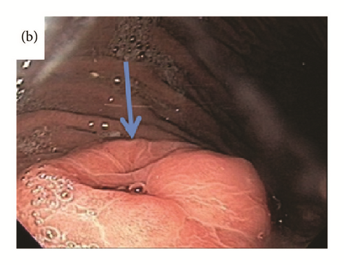 Details are in the caption following the image