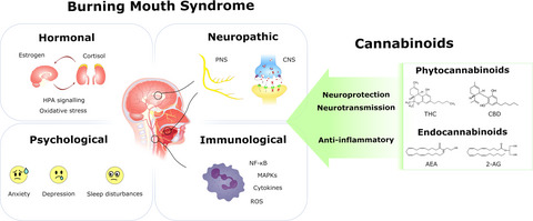 Recent advances in the understanding of the aetiology and therapeutic strategies in burning mouth syndrome: Focus on the actions of cannabinoids