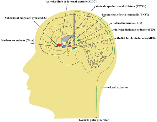 Details are in the caption following the image Details are in the caption following the image