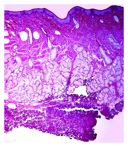 Details are in the caption following the image