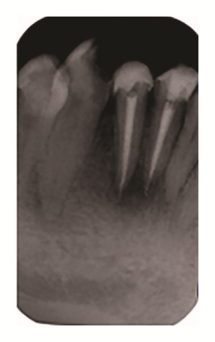 Details are in the caption following the image