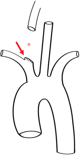 Details are in the caption following the image