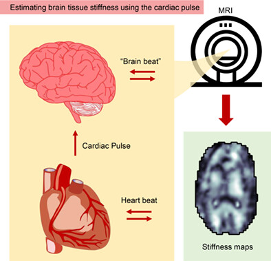 Estimating the viscoelastic properties of the human brain at 7 T MRI using intrinsic MRE and nonlinear inversion