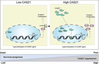 Transcription factor CASZ1 increases an oncogenic transcriptional process in tumorigenesis and progression of glioma cells