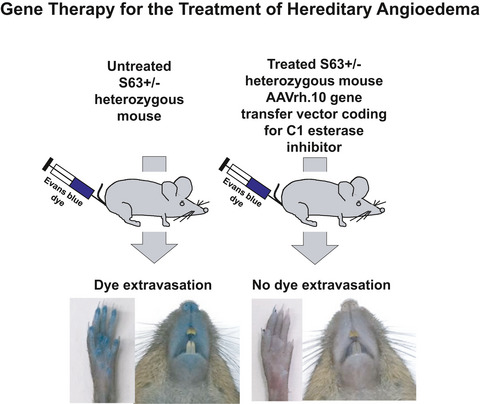 Gene therapy for C1 esterase inhibitor deficiency in a Murine Model of Hereditary angioedema