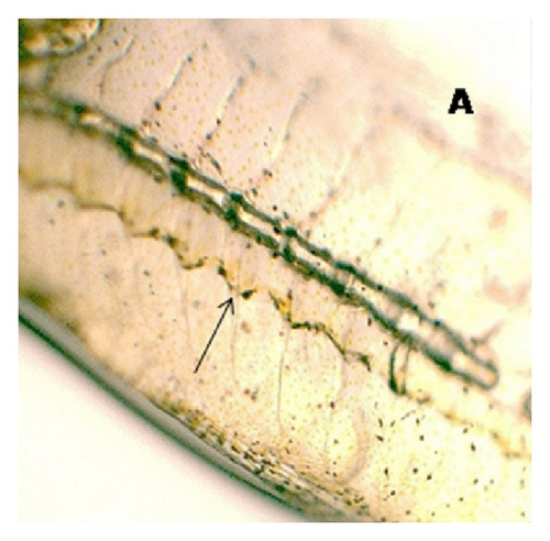 Details are in the caption following the image