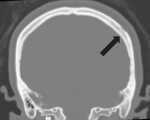 Details are in the caption following the image