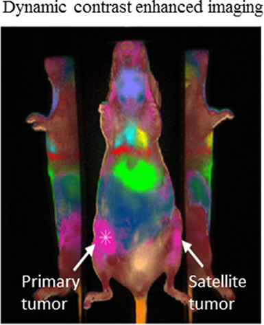 Perfusion-based fluorescence imaging method delineates diverse organs and identifies multifocal tumors using generic near-infrared molecular probes