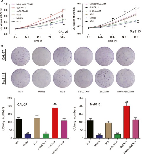 MiR-375/SLC7A11 axis regulates oral squamous cell carcinoma proliferation and invasion