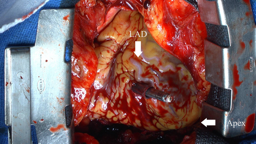 Details are in the caption following the image Details are in the caption following the image