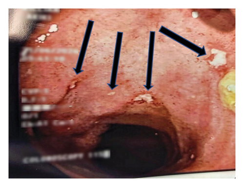 Details are in the caption following the image Details are in the caption following the image