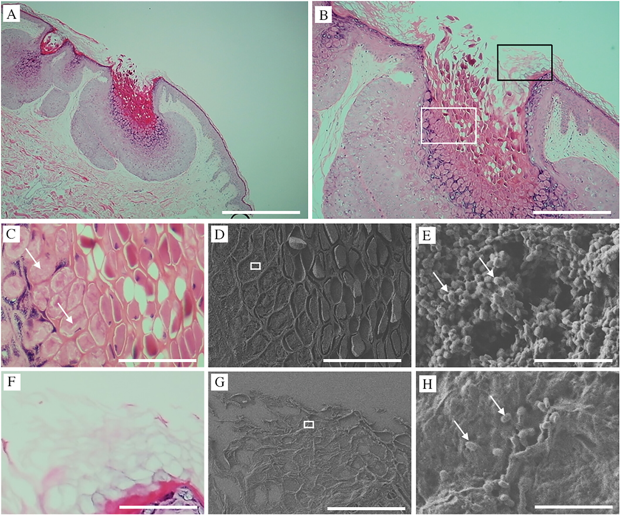Visualization of Molluscum Contagiosum Virus in FFPE Skin Sections Using NanoSuit-CLEM: Ultrastructural Evidence of Viral Spread via Skin Barrier Disruption