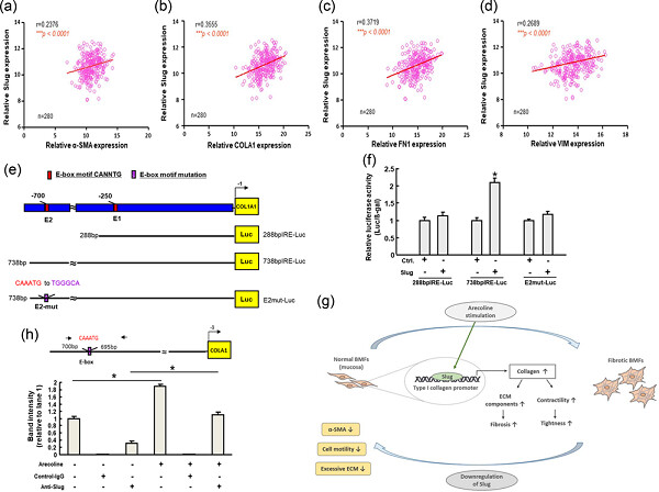 Slug mediates myofibroblastic differentiation to promote fibrogenesis in buccal mucosa