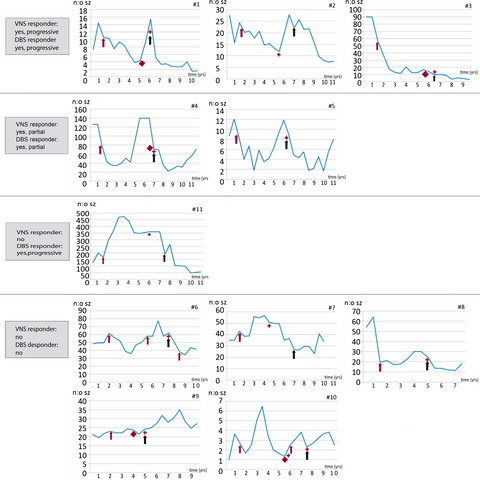 Similarities between the responses to ANT-DBS and prior VNS in refractory epilepsy