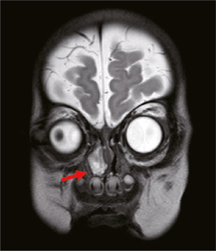 Details are in the caption following the image