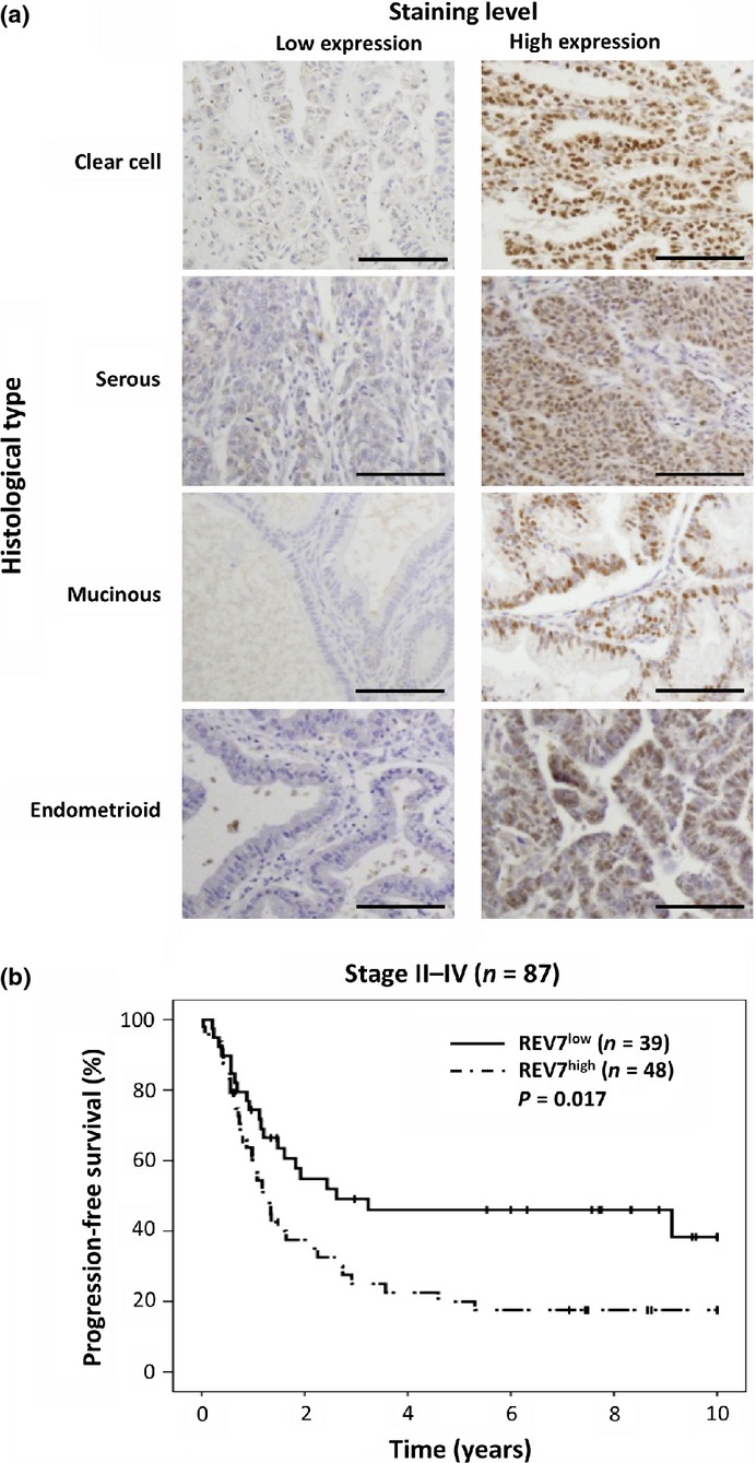 Suppression of REV7 enhances cisplatin sensitivity in ovarian clear cell carcinoma cells