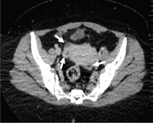 Details are in the caption following the image Details are in the caption following the image