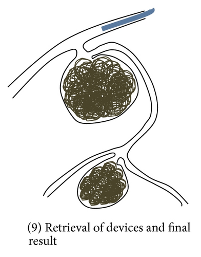 Details are in the caption following the image