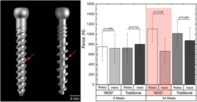 Evaluation of instrumentation and pedicle screw design for posterior lumbar fixation: A pre-clinical in vivo/ex vivo ovine model