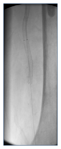 Details are in the caption following the image