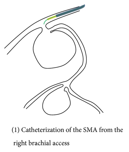 Details are in the caption following the image