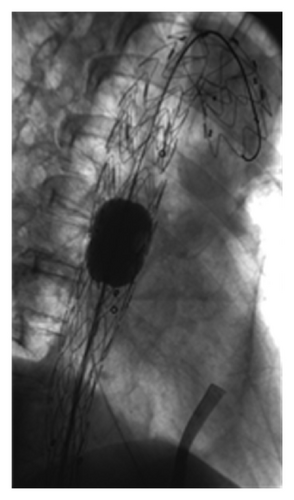 Details are in the caption following the image