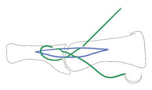 Details are in the caption following the image