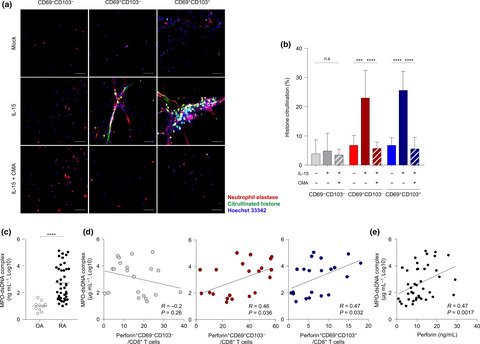 Synovial fluid CD69+CD8+ T cells with tissue-resident phenotype mediate perforin-dependent citrullination in rheumatoid arthritis