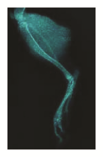 Details are in the caption following the image