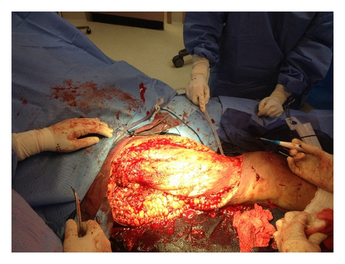 Details are in the caption following the image Details are in the caption following the image